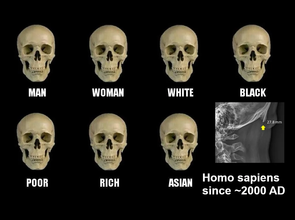 It's 3am and I just found out I have a horn at the back of my head